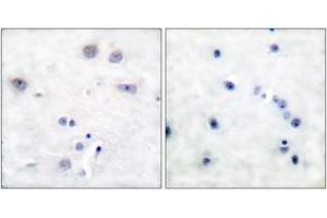 Immunohistochemistry analysis of paraffin-embedded human brain tissue, using Shc (Ab-427) Antibody. (SHC1 抗体  (AA 393-442))