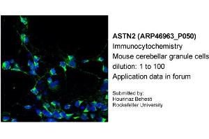 Immunocytochemistry --Sample Type: Mouse cerebellar granule cellsDilution: 1:100 (Astrotactin 2 抗体  (N-Term))