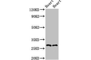 Western Blot Positive WB detected in: Rat heart tissue, Mouse heart tissue All lanes: MYF5 antibody at 2. (MYF5 抗体  (AA 1-255))