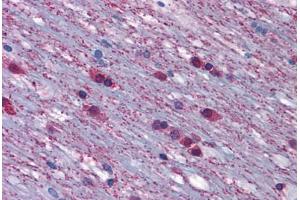 Anti-ADRA1A antibody  ABIN1048308 IHC staining of human brain. (alpha 1 Adrenergic Receptor 抗体  (Cytoplasmic Domain))