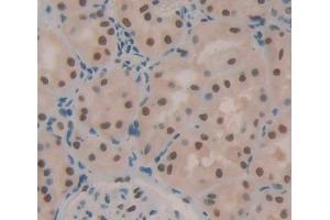 Immunohistochemistry (IHC) image for anti-Transcription Elongation Factor B (SIII), Polypeptide 2 (18kDa, Elongin B) (TCEB2) (AA 1-118) antibody (ABIN7445372)