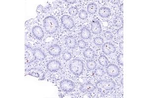 A moderate number of helicobacter pylori in a stomach sample (Helicobacter Pylori 抗体  (AA 323-445))