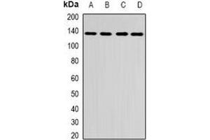 Western blot analysis of CENP-C expression in A431 (A), HepG2 (B), mouse brain (C), rat brain (D) whole cell lysates. (CENPC1 抗体)