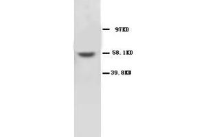 MMP16 Polyclonal Antibody (MMP16 抗体  (C-Term))