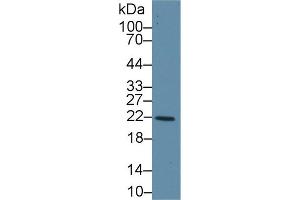 Western Blot; Sample: Human Liver lysate; Primary Ab: 1µg/ml Rabbit Anti-Human GSTk1 Antibody Second Ab: 0. (GSTK1 抗体  (AA 7-222))