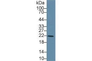 Western Blot; Sample: Human Liver lysate; Primary Ab: 1µg/ml Rabbit Anti-Human GSTk1 Antibody Second Ab: 0. (GSTK1 抗体  (AA 7-222))