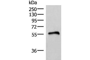 Western blot analysis of Human heart tissue lysate using RETREG1 Polyclonal Antibody at dilution of 1:400 (FAM134B 抗体)