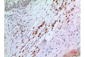 Immunohistochemistry (IHC) analysis of paraffin-embedded Human Brain, antibody was diluted at 1:100. (IFN-AlphaR2 (N-Term) 抗体)