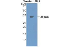 Western Blotting (WB) image for anti-Oxidized Low Density Lipoprotein (Lectin-Like) Receptor 1 (OLR1) (AA 51-314) antibody (ABIN1859679) (OLR1 抗体  (AA 51-314))