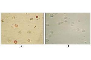 Immunocytochemistry analysis of TPA induced BCBL-1 cells (A) and uninduced BCBL-1 cells (B) using KSHV ORF45 antibody with AEC staining. (KSHVORF45 抗体)