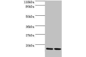 Western blot All lanes: RPL27 antibody at 2 μg/mL Lane 1: EC109 whole cell lysate Lane 2: 293T whole cell lysate Secondary Goat polyclonal to rabbit IgG at 1/15000 dilution Predicted band size: 16 kDa Observed band size: 16 kDa (RPL27 抗体  (AA 2-136))