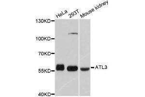 Western blot analysis of extracts of various cell lines, using ATL3 antibody. (ATL3 抗体  (AA 360-440))