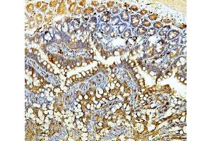 IHC analysis of Galectin 3/LGALS3 using anti Galectin 3/LGALS3 antibody (ABIN6719486).