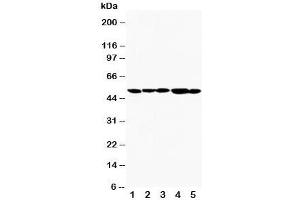 Western blot testing of TIM-1 antibody and Lane 1:  SMMC-7721;  2: HeLa;  3: PANC;  4: MM231;  5: MM453. (HAVCR1 抗体  (AA 289-307))