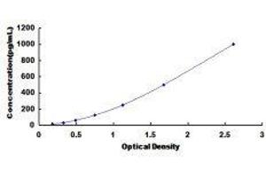 ELISA image for Slow Skeletal Troponin T (TNNT1) ELISA Kit (ABIN433507) (TNNT1 ELISA 试剂盒)