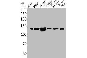Western Blot analysis of A549 SW620 HT29 Jurkat mouse kidney mouse lung cells using CD133 Polyclonal Antibody (CD133 抗体  (N-Term))