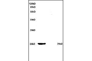 Formalin-fixed and paraffin embedded rat kidney tissue labeled with Anti Ferritin Polyclonal Antibody, Unconjugated (ABIN759641) at 1:200 followed by conjugation to the secondary antibody and DAB staining (FTH1 抗体  (AA 1-100))