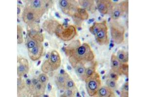 Used in DAB staining on fromalin fixed paraffin-embedded Liver tissue (CSNK1A1 抗体  (AA 114-324))