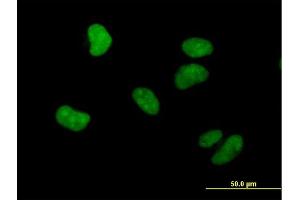 Immunofluorescence of purified MaxPab antibody to WHSC1 on HeLa cell. (WHSC1 抗体  (AA 1-647))