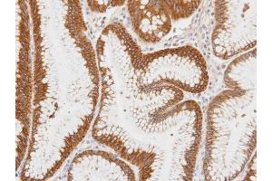 IHC-P Image Immunohistochemical analysis of paraffin-embedded human gastric tissue, using Centaurin alpha 1, antibody at 1:100 dilution. (ADAP1 抗体  (C-Term))