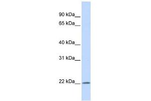 IFN Alpha 5 antibody used at 1 ug/ml to detect target protein.