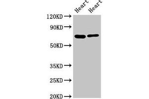 Western Blot Positive WB detected in: Rat heart tisseu, Mouse heart tissue All lanes: FASTKD2 antibody at 8 μg/mL Secondary Goat polyclonal to rabbit IgG at 1/50000 dilution Predicted band size: 82, 75 kDa Observed band size: 75 kDa (FASTKD2 抗体  (AA 117-203))