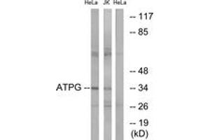 Image no. 1 for anti-ATP Synthase, H+ Transporting, Mitochondrial F1 Complex, gamma Polypeptide 1 (ATP5C1) (AA 131-180) antibody (ABIN2890140)