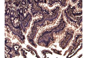 Immunohistochemistry (IHC) image for anti-Tripartite Motif Containing 5 (TRIM5) (N-Term) antibody (ABIN184983)