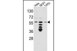 Western blot analysis of FKBP4 Antibody (Center) (ABIN391579 and ABIN2841513) in Hela,MCF7,T47D cell line lysates(35 μg/lane). (FKBP4 抗体  (AA 186-216))