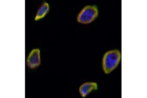ABIN6265731 and ABIN6266699 staining Hela by IF/ICC. (TRIM24 抗体  (C-Term))