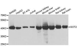 Western blot analysis of extracts of various cell lines, using GOT2 antibody. (GOT2 抗体  (AA 30-200))