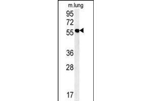ZMYND10 Antibody (C-term) (ABIN652018 and ABIN2840499) western blot analysis in mouse lung tissue lysates (15 μg/lane). (ZMYND10 抗体  (C-Term))