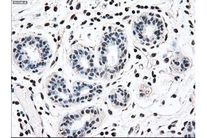Immunohistochemical staining of paraffin-embedded breast tissue using anti-MAP2K2 mouse monoclonal antibody. (MEK2 抗体)