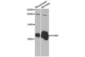 Western blot analysis of extracts of various cell lines, using S100B antibody. (S100B 抗体  (AA 1-92))