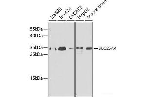 Western blot analysis of extracts of various cell lines using SLC25A4 Polyclonal Antibody. (SLC25A4 抗体)
