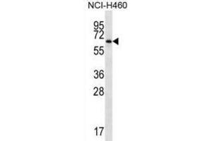 Western Blotting (WB) image for anti-Zinc Finger Protein 340 (ZNF340) antibody (ABIN2998810)