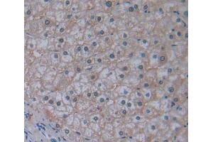 Used in DAB staining on fromalin fixed paraffin- embedded liver tissue (ABCB10 抗体  (AA 492-738))