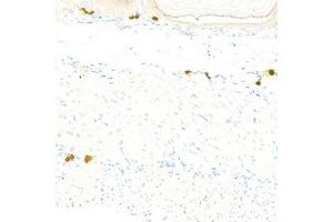 Immunohistochemistry analysis of paraffin-embedded mousestomachusing Chymase (ABIN7073506) at dilution of 1:1000 (CMA1 抗体)