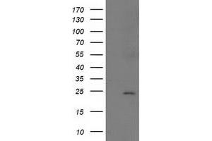 Western Blotting (WB) image for anti-Suppressor of Cytokine Signaling 3 (SOCS3) antibody (ABIN1501057) (SOCS3 抗体)