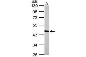 WB Image Sample (50 ug of whole cell lysate) A: Mouse brain 10% SDS PAGE antibody diluted at 1:1000 (PGK1 抗体)