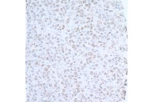 Immunohistochemistry (IHC) image for anti-Ubiquitin Protein Ligase E3 Component N-Recognin 5 (UBR5) (AA 600-650) antibody (ABIN7454646) (UBR5 抗体  (AA 600-650))