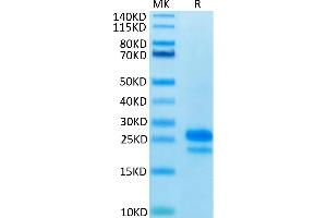 Human VEGF165 on Tris-Bis PAGE under reduced condition. (VEGF 165 蛋白)