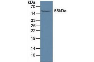 Detection of ALDH1A1 in Rat Liver Tissue using Polyclonal Antibody to Aldehyde Dehydrogenase 1 Family, Member A1 (ALDH1A1) (ALDH1A1 抗体  (AA 2-501))