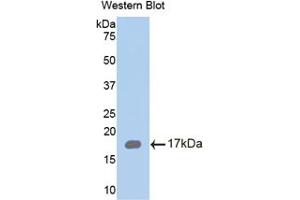 Western blot analysis of the recombinant protein. (Chemerin 抗体  (AA 33-158))