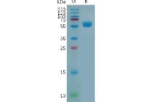 Mouse C Protein, hFc Tag on SDS-PAGE under reducing condition.