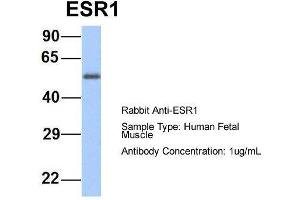 Host:  Rabbit  Target Name:  ESR1  Sample Type:  Human Fetal Muscle  Antibody Dilution:  1. (Estrogen Receptor alpha 抗体  (Middle Region))