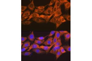 Immunofluorescence analysis of NIH-3T3 cells using SOCS2 Rabbit mAb (ABIN7270641) at dilution of 1:100 (40x lens).