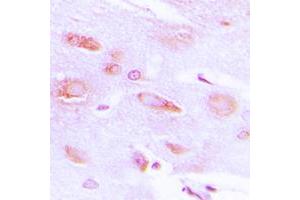 Immunohistochemistry (IHC) image for anti-Adrenergic, Beta, Receptor Kinase 1 (ADRBK1) (N-Term), (pSer29) antibody (ABIN7294872)