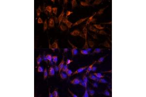 Immunofluorescence analysis of NIH-3T3 cells using YWHAH Polyclonal Antibody (ABIN6131142, ABIN6150348, ABIN6150349 and ABIN6224884) at dilution of 1:100 (40x lens). (14-3-3 eta 抗体  (AA 1-246))
