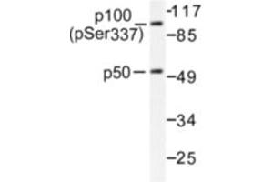Image no. 1 for anti-Nuclear Factor of kappa Light Polypeptide Gene Enhancer in B-Cells 1 (NFKB1) (pSer337) antibody (ABIN318079) (NFKB1 抗体  (pSer337))